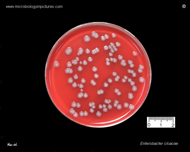 Бактерия клоака Enterobacter cloacae