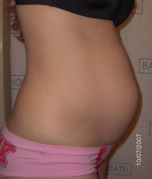 Как выглядит животик на 12 неделе беременности фото