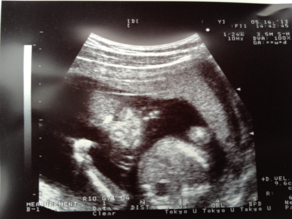 Мальчик 19 недель. УЗИ 19 недель беременности девочка.