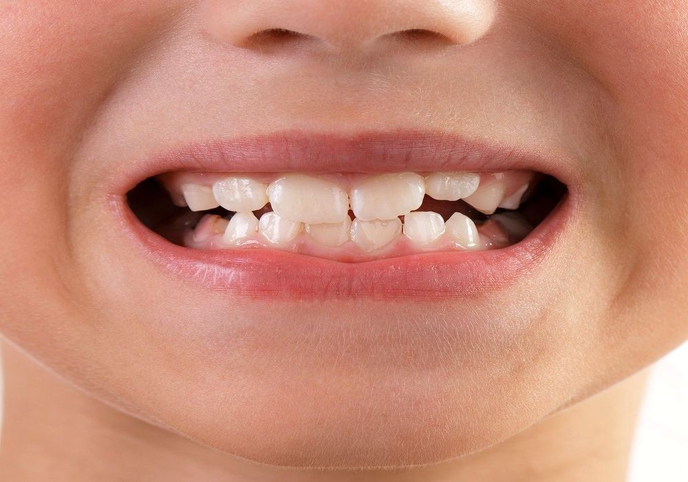 Клык фото зуба. Передние резцы у детей. Передние коренные зубы.