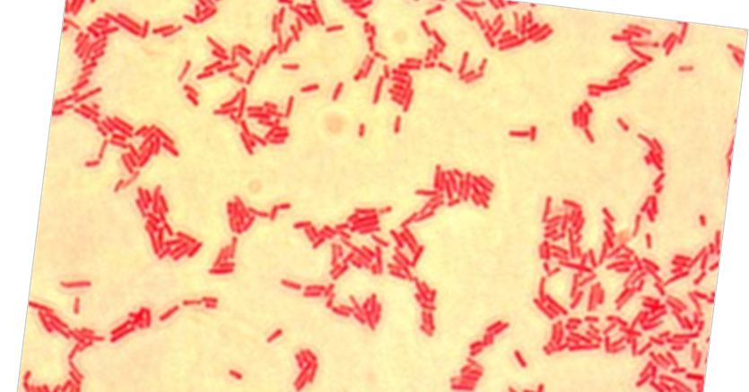 Энтеробактерии в мазке. Serratia marcescens микроскопия. Serratia marcescens по Граму. Серрация ликвефациенс. Serratia в микроскопе.