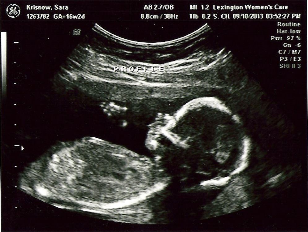 17 недель развитие. УЗИ 17 недель беременности рост. УЗИ 15 недель беременности.