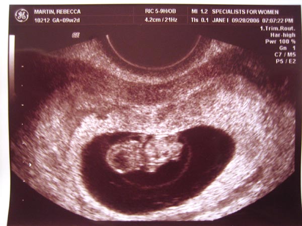 Масса 6 недель. Размер зародыша на 6 неделе беременности. Размер плода на 5 неделе беременности. 5-6 Недель беременности размер плода. 5 Недель беременности размер.