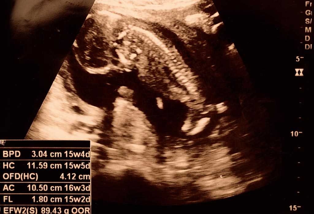 Малыш на 16 неделе беременности в животе фото плода