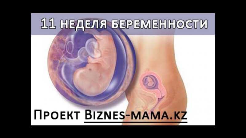 Токсикоз на 11 неделе. Беременность 11. 11 Акушерская неделя беременности.