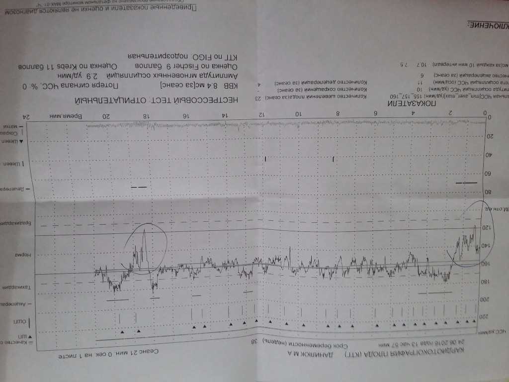 Ктг на 39 неделе беременности