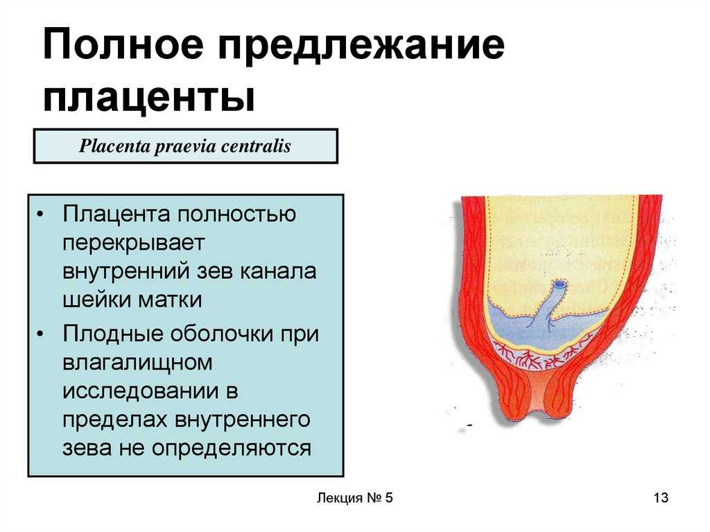 Плацента внутренний зев