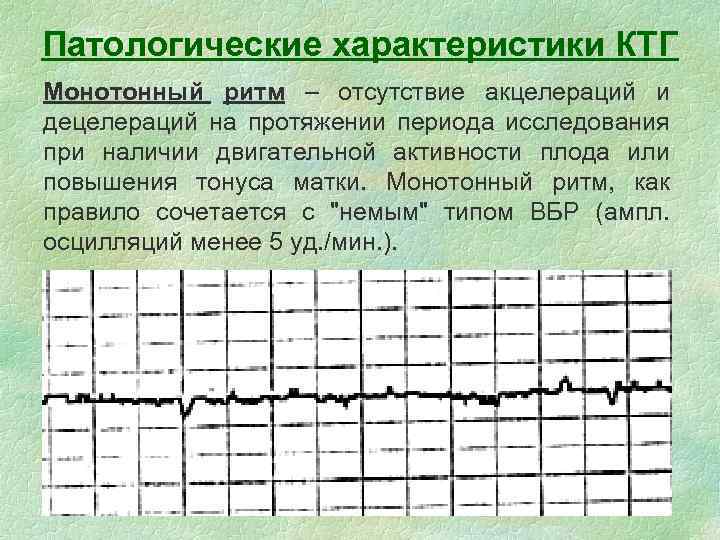 Ритмичные толчки