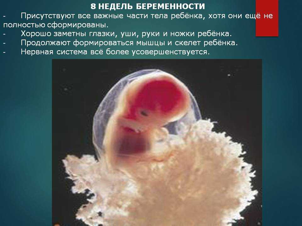 Россия 8 недель. Зародыш ребенка 8 недель. 8 Недель беременности Эмбрио.