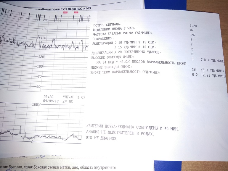 Первые шевеления плода при беременности форум. Эпизоды высокой вариабельности на КТГ норма. Низкая вариабельность КТГ. Низкие эпизоды на КТГ. Вариабельность 6.4 на КТГ.