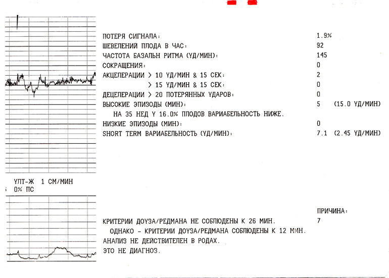 Первые шевеления плода при беременности форум. Критерии Доуза Редмана КТГ. Критерии КТГ норма. КТГ критерии соблюдены. Кратковременная вариабельность КТГ.