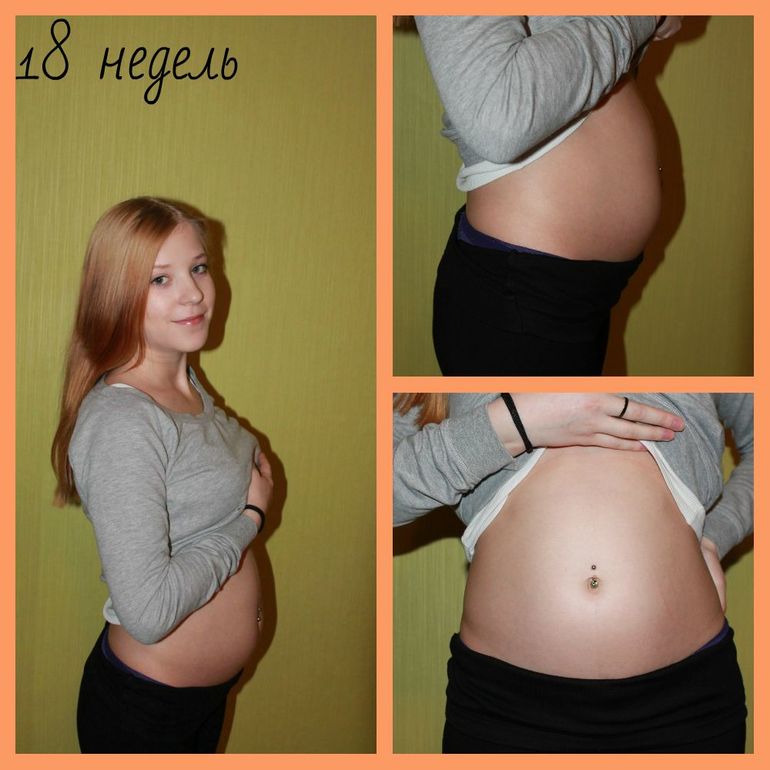 18 недель тянет живот. Живот на 18 неделе. Живот на 17-18 неделе беременности. 18 Недель беременности живо. Живот у беременных на 18 неделе.