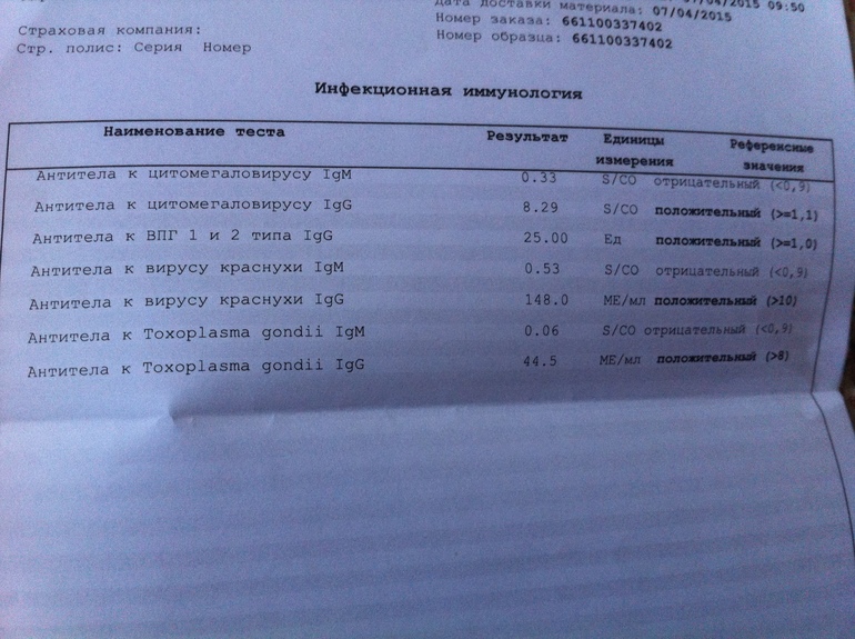 Цмв igm. Токсоплазма гондии антитела IGG норма. Антитела к вирусу краснухи IGM норма. Антитела к вирусу краснухи IGM 0.2. Антитела к Toxoplasma gondii IGG отрицательный что.