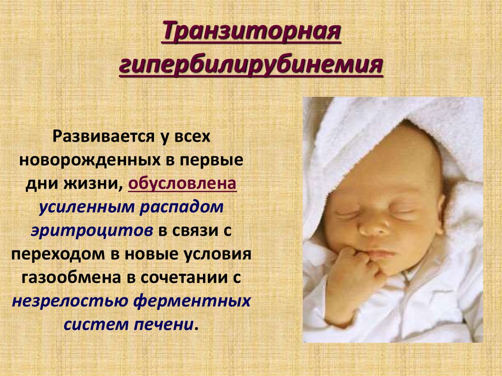 Желтуха у детей мкб 10. Конъюгационная желтуха у новорожденных. Транзиторная желтуха новорожденных. Гипербилирубинемия желтуха новорожденных. Гипербилирубинемия у новорожденных.