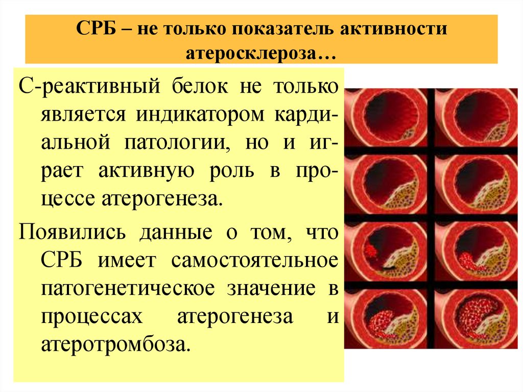 Появились данные. СРБ показатели. Атеросклероз показатели. Ц реактивный белок. С-реактивный белок (СРБ).