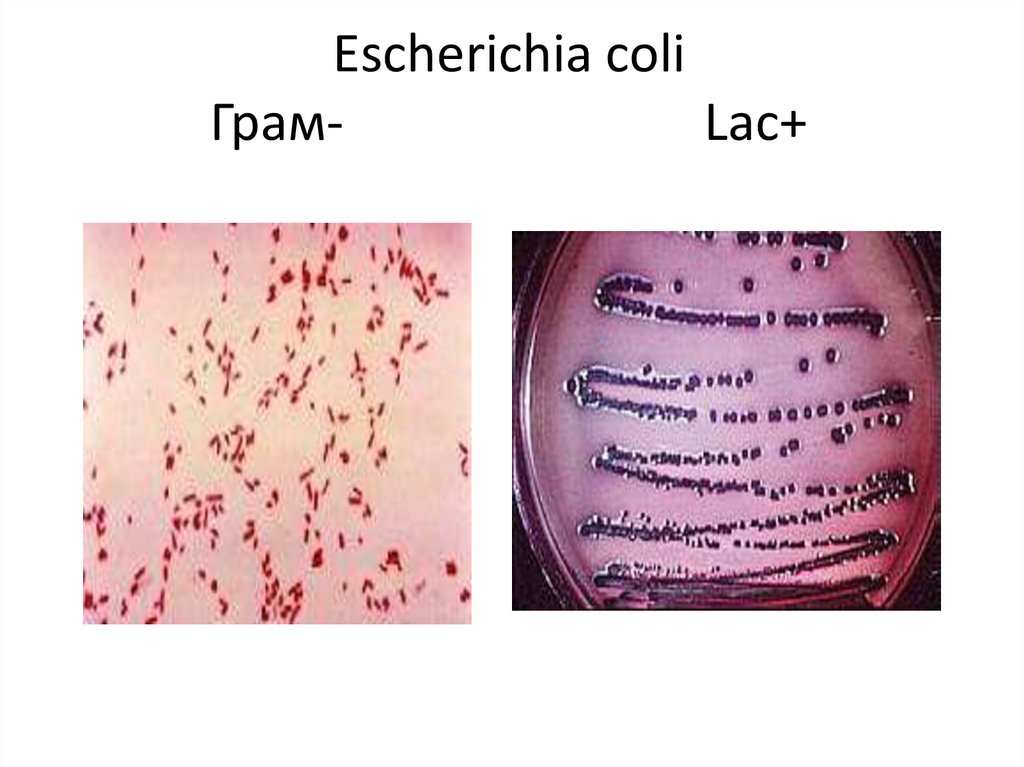 Escherichia coli обнаружено