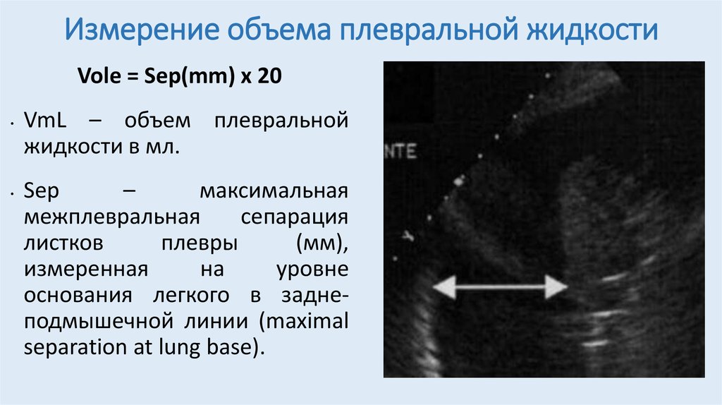 Узи определение. Протокол УЗИ плевральных полостей и легких. Сепарация листков плевры на УЗИ. Протокол УЗИ плевральных полостей гидроторакс. Жидкость в плевральной полости на УЗИ протокол.