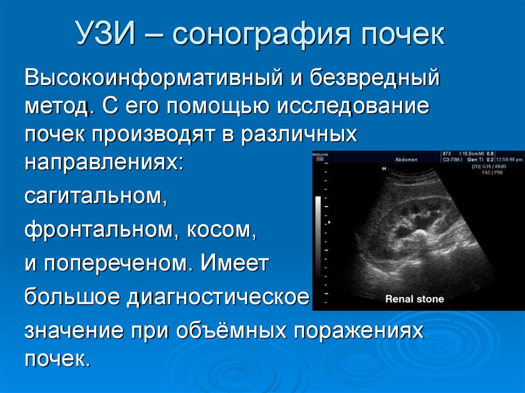 Чем отличаются узи. Ультразвуковые исследования(сонография ) почек. Ультразвуковая диагностика (сонография, УЗИ). УЗИ почек сонограмма. Почки алгоритм исследования УЗИ.