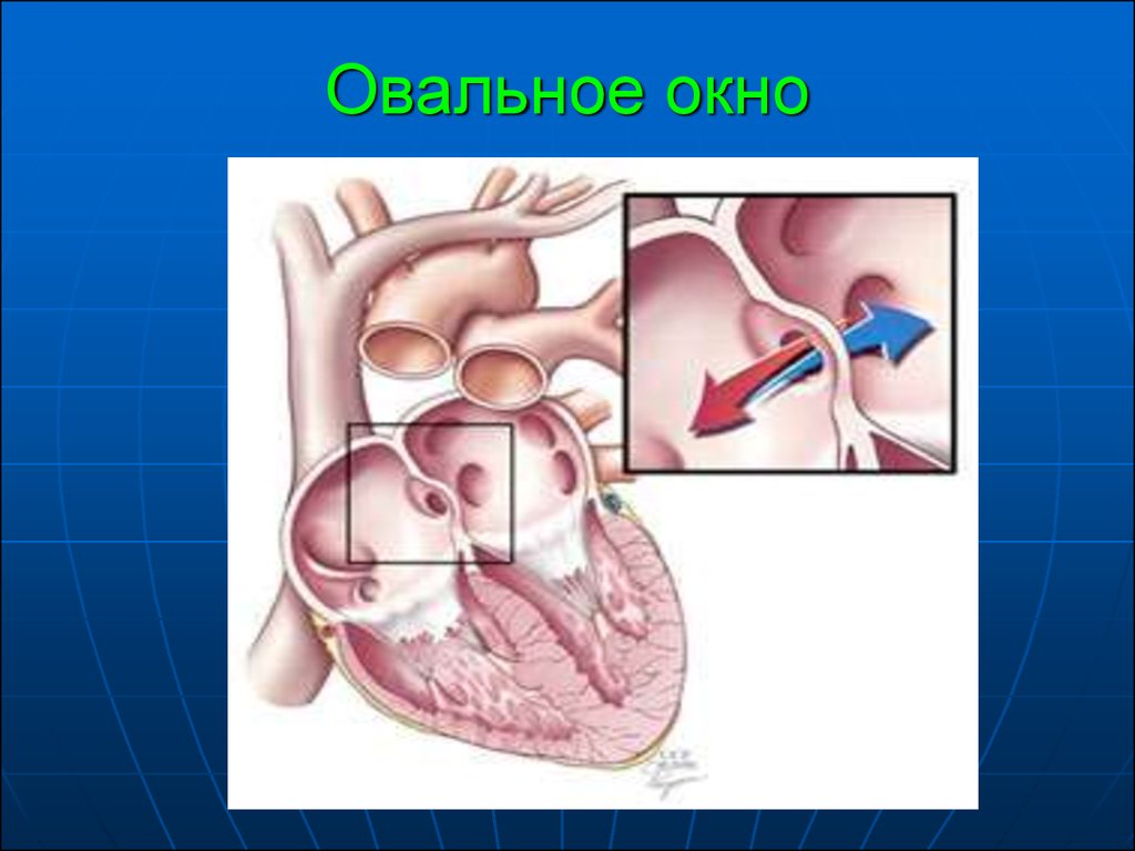 Овальное окно фото у ребенка