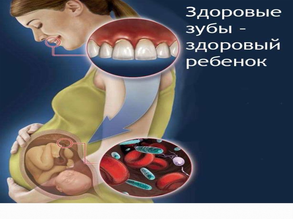 Полости рта беременности