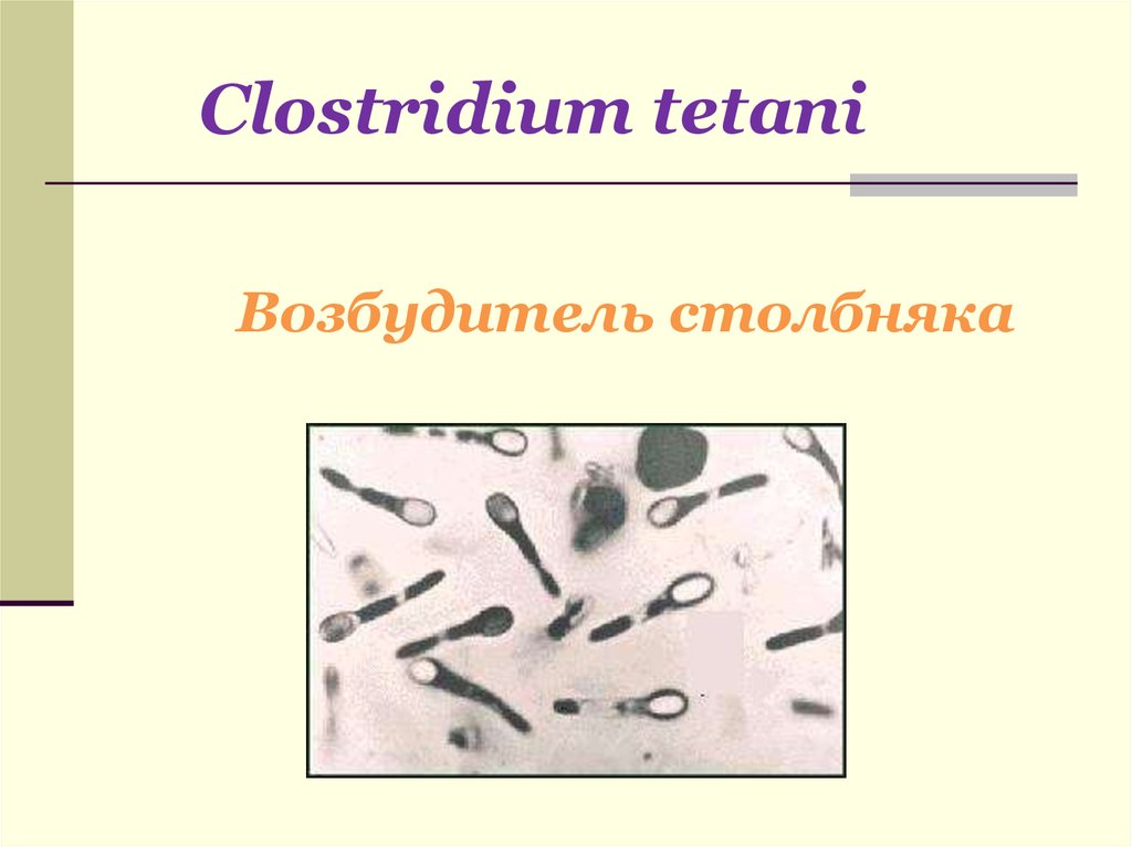 Столбняк возбудитель. Столбнячная палочка Clostridium tetani. Споры возбудителя столбняка окраска по Граму. Возбудитель столбняка Clostridium tetani микробиология.