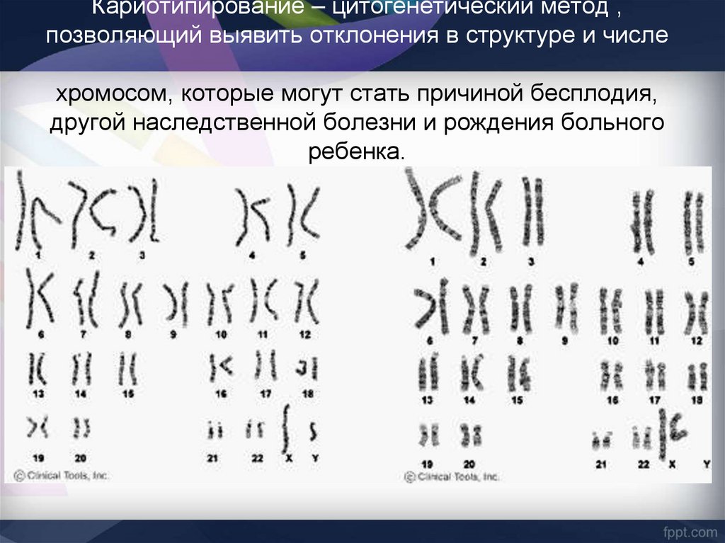 Кариотип сдать анализ. Кариотипирование. Кариотипирование методы. Цитогенетический метод кариотипирование. Кариотипирование хромосом.