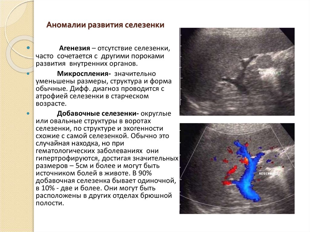 Селезенка размеры