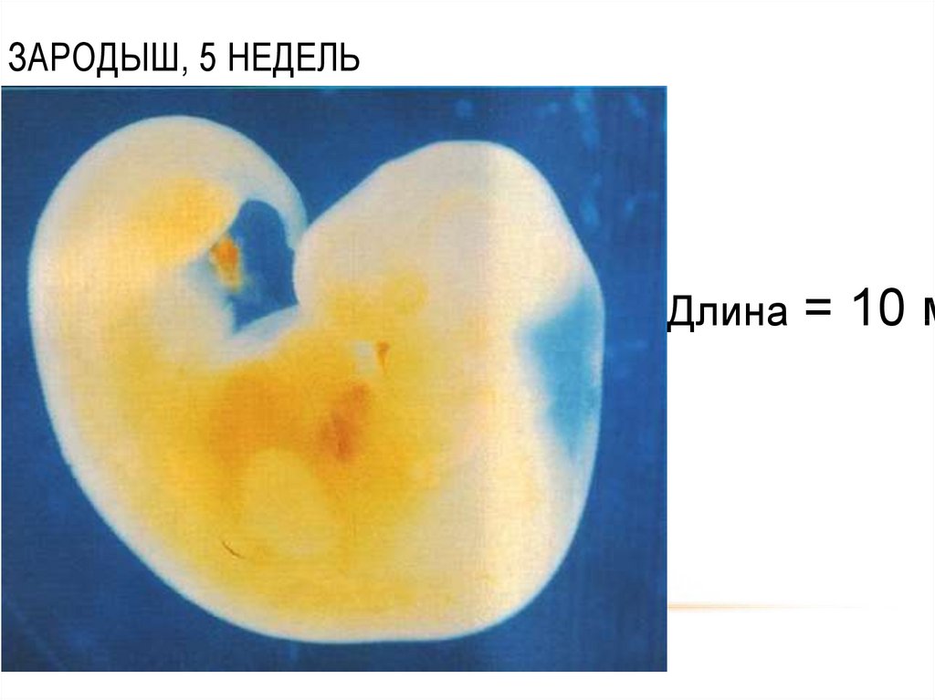 Эмбрион 5 6 недель фото как выглядит беременности