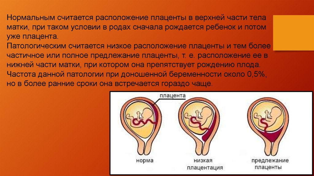 Расположение матки. Краевое боковое центральное низкое предлежание плаценты. Нормальное расположение плаценты. Нормальное предлежание плаценты. Нормальное прикрепление плаценты.