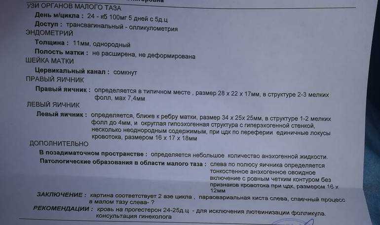 Узи омт что. Ультразвуковое исследование органов малого таза. УЗИ малого таза УЗИ малого таза. УЗИ органов малого таза у женщин. УЗИ органов малого таза беременность.