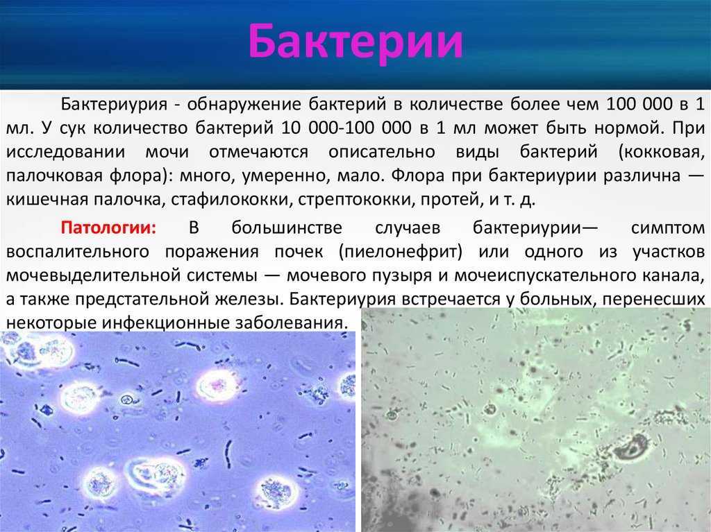 Бактериурия характерна. Бактериурия микроскопия. Бактерии в моче. Микроорганизмы в моче. Бактерии в осадке мочи.