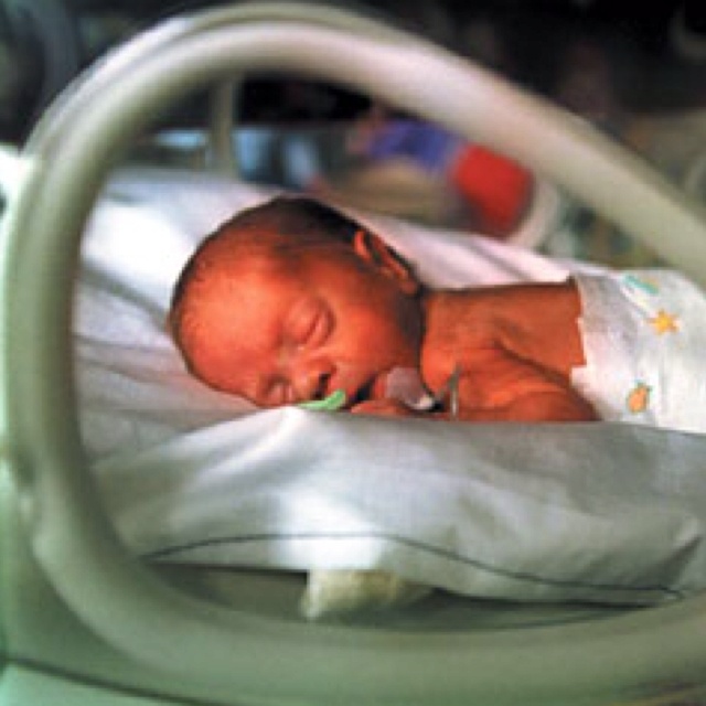 Ребенок рожденный в 7 месяцев фото
