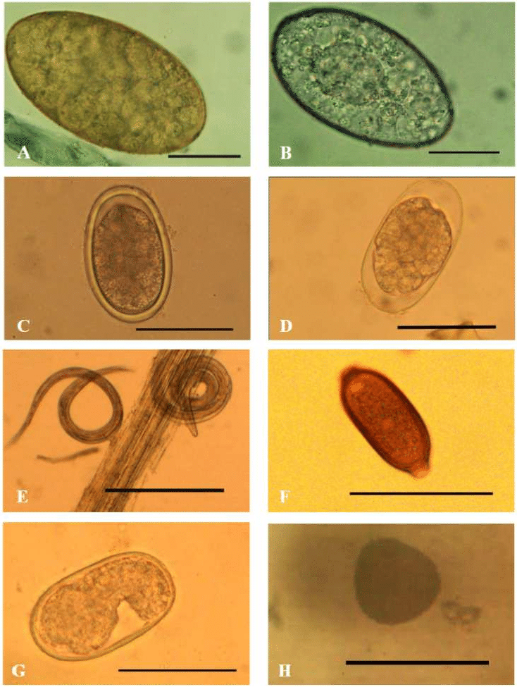 Среду яйца глистов. Яйца гельминтов микроскопия. Яйца гельминтов Capillaria Bovis. Яйца остриц микроскопия. Микроскопия кала яйца гельминтов.