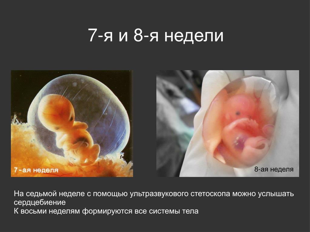 7 недель что происходит с малышом. Сердцебиение ребенка на 8 неделе беременности. Эмбрион на 8 неделе беременности.