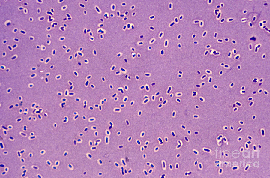 Палочка пневмонии. Klebsiella pneumoniae Бурри Гинса. Палочка Фридлендера Klebsiella. Клебсиелла пневмония микроскопия. Klebsiella pneumoniae под микроскопом.