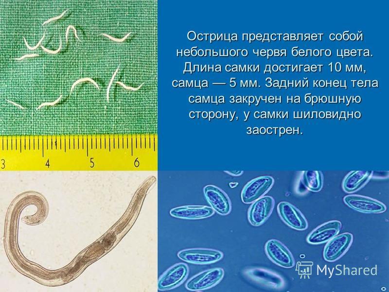 Чем представлены черви. Черви паразиты Острица. Острица паразитология.