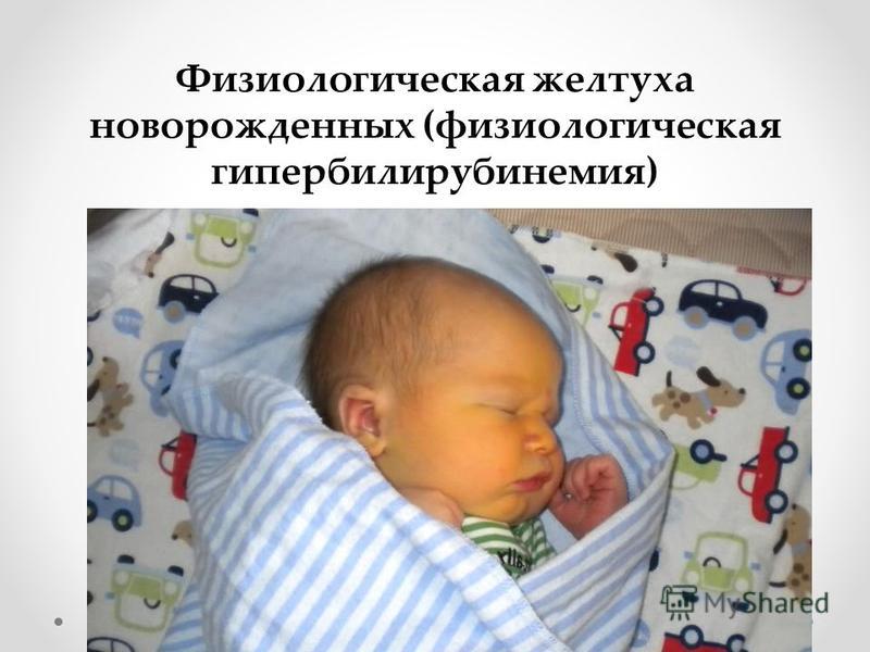 Желтуха новорожденных отзывы. Физиологическая гипербилирубинемия. Гипербилирубинемия у новорожденных. Физиологическая гипербилирубинемия у новорожденных. Транзиторная гипербилирубинемия.