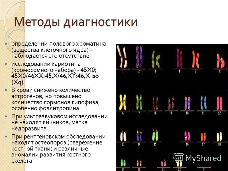 Кариотип 46 хх. Кариотип 46. Кариотип 46хх), человек. 46 XX кариотип. 45 ХХ кариотип.