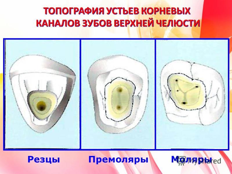 Каналы в 37 зубе схема - 85 фото