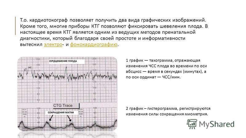 Тонус матки на КТГ. Оценка состояния плода методом КТГ алгоритм. Наружная гистерография. КТГ на 39 неделе беременности.