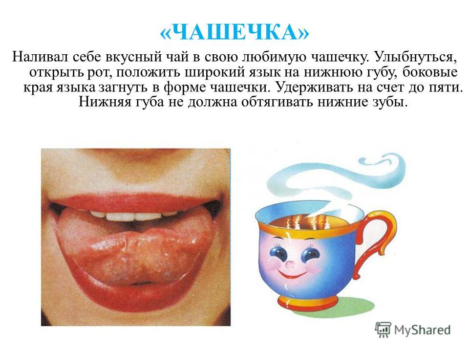 Накажем непослушный язычок артикуляционная гимнастика картинка