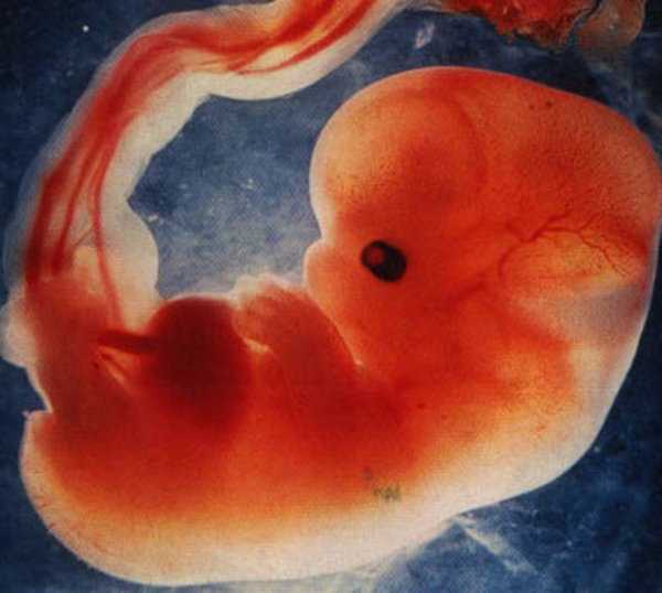 Эмбрион 5 недель фото что сформировалось