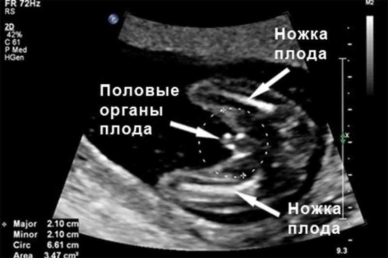 16 неделя беременности размер плода фото узи