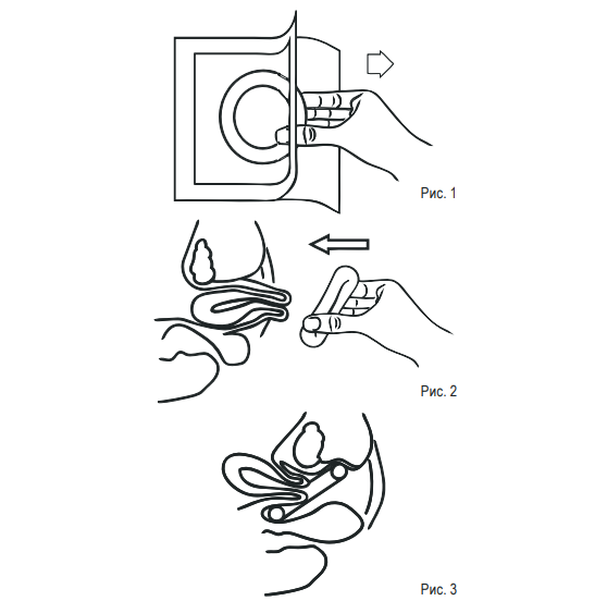 В отверстие вставляется веселье начинается. Пессарий силиконовый Симург кольцо толстое. Акушерский пессарий противозачаточные. Влагалищное кольцо. Введение маточного кольца.