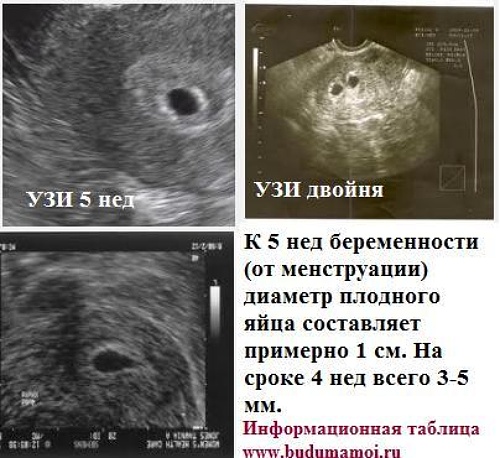 Когда можно увидеть беременность. Как выглядит эмбрион в 6 недель на УЗИ. УЗИ плодное яйцо в матке 3 недели беременности. Как выглядит эмбрион в 5 недель на УЗИ. УЗИ 6 недель беременности плодное яйцо на УЗИ.