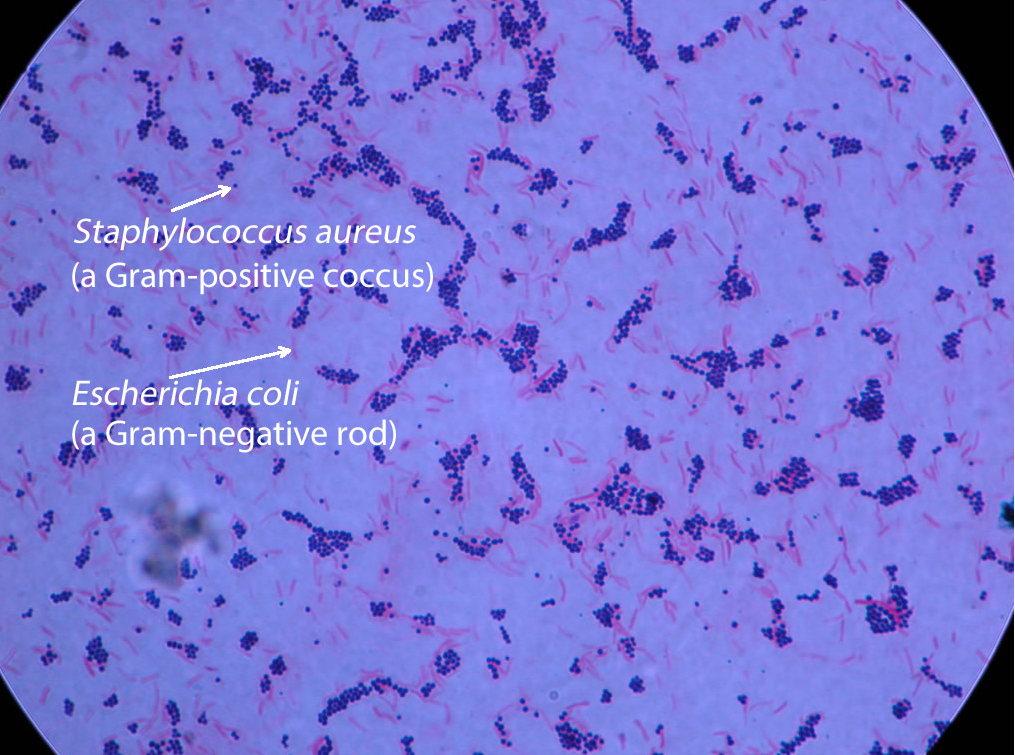 Gram staining e. coli. Эшерихия коли окраска по Граму. Эшерихии в микроскопе. Эшерихии под микроскопом.