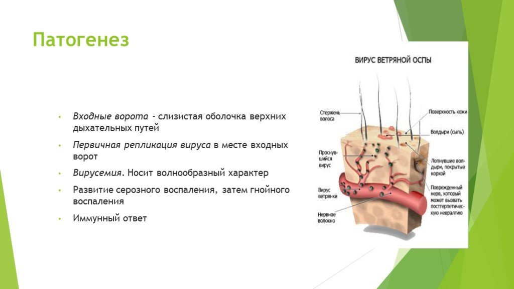 Ветряная оспа вирус. Патогенез ветряной оспы. Вирус ветряной оспы патогенез. Входные ворота ветряной оспы. Ветряная оспа патогенез.