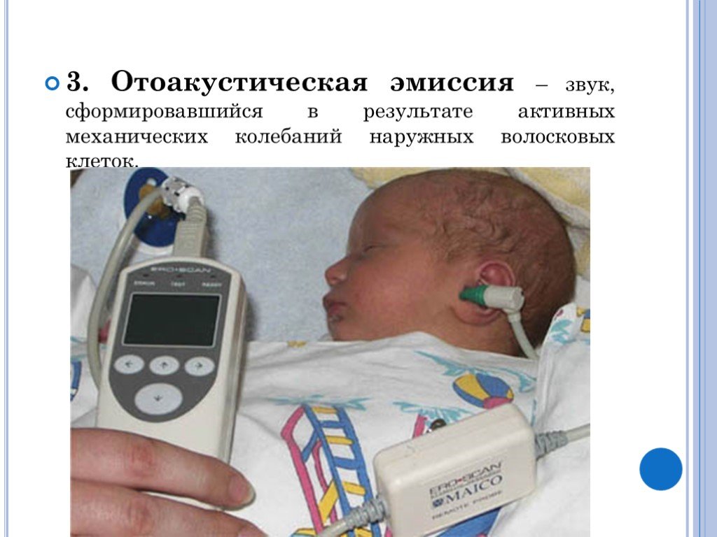 Регистрация отоакустической эмиссии. Отоакустическая эмиссия. Метод отоакустической эмиссии. Аудиологический скрининг новорожденных. Аппарат отоакустической эмиссии для новорожденных.