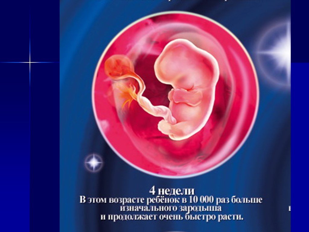 Плод сроком 4 недели. Зародыш 4 недели беременности фото плода. Юбрион в 4 недели беременности. Плод на 4 неделе беременности. Ребёнок на 4 неделе беременности.