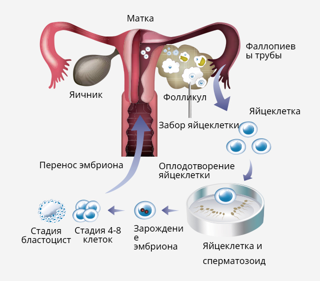 Эко с донорской яйцеклеткой форум